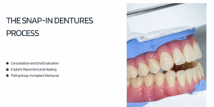 The Snap-In Dentures Process
