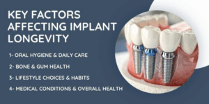 Key Factors Affecting Implant Longevity