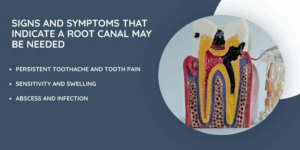 Signs and Symptoms That Indicate a Root Canal May Be Needed
