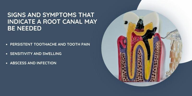 Signs and Symptoms That Indicate a Root Canal May Be Needed
