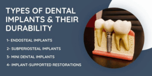 Types of Dental Implants and Their Durability