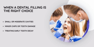 When a Dental Filling Is the Right Choice