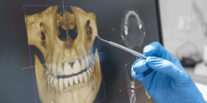 Importance of a Professional All-on-X Consultation