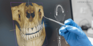 Importance of a Professional All-on-X Consultation