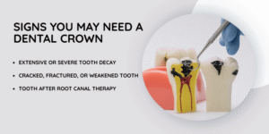 Signs You May Need a Dental Crown
