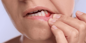 Recognizing Signs of Implant Failure