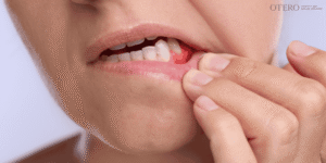 Recognizing Signs of Implant Failure