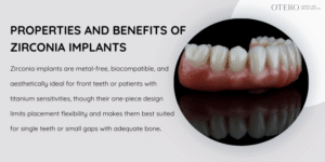 Zirconia Dental Implants Properties and Advantages