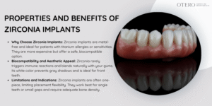 Zirconia Dental Implants: Properties and Advantages