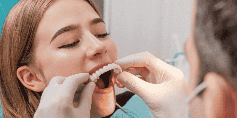 snap in dentures attachment types