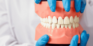 bone loss with dentures