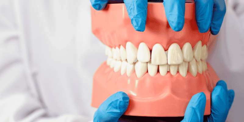 bone loss with dentures