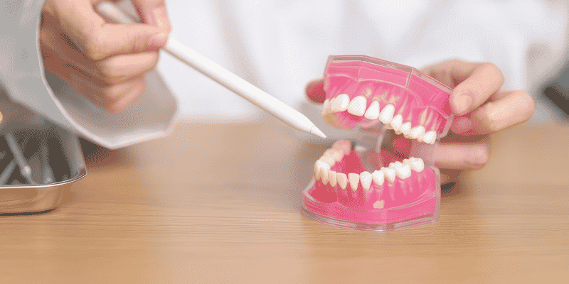 dental implant success rate upper vs lower jaw