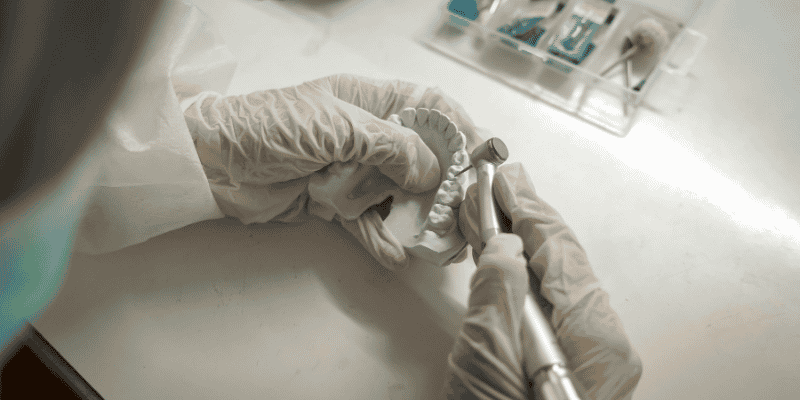 Digital Dentures vs Conventional Dentures