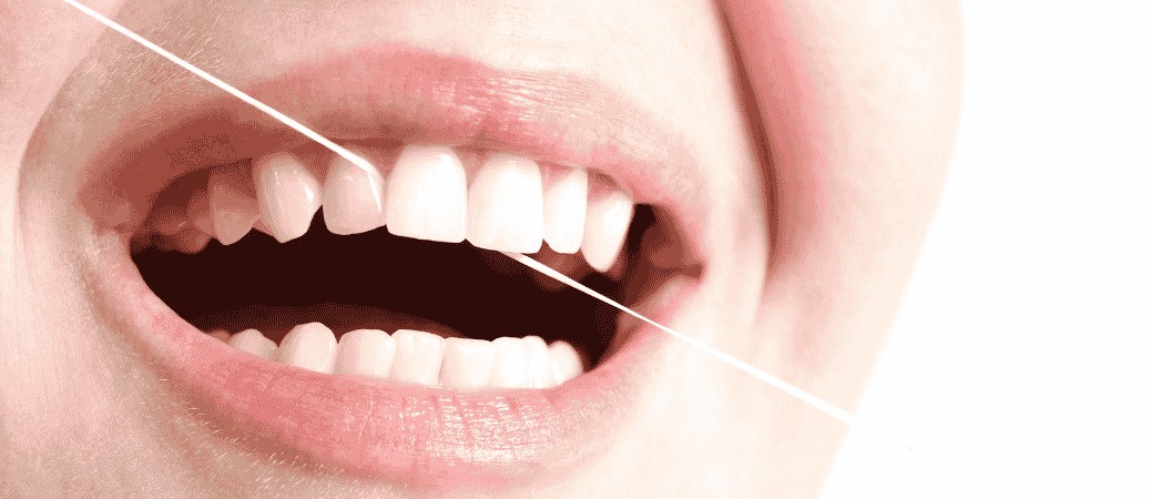 Brushing, Flossing, and Keeping Aligners Clean