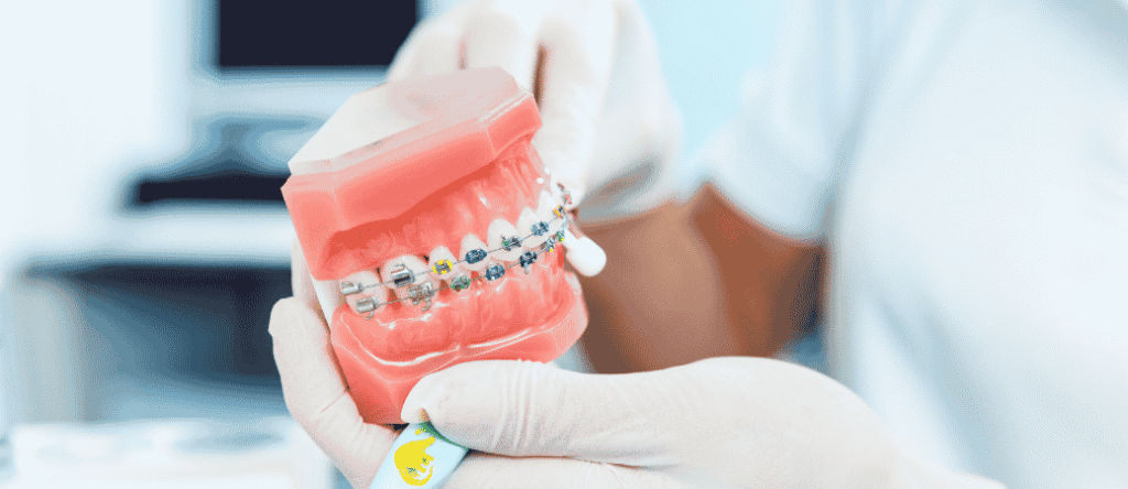 adult orthodontic treatment trends