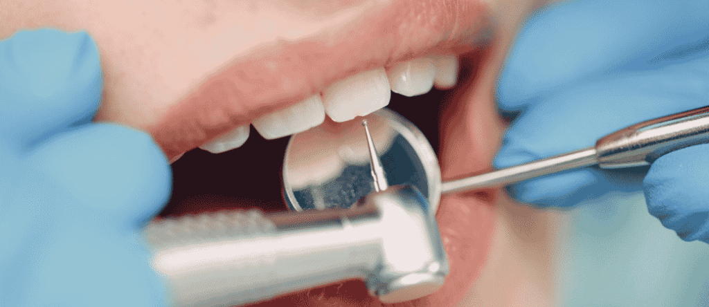 how often should you get a dental cleaning