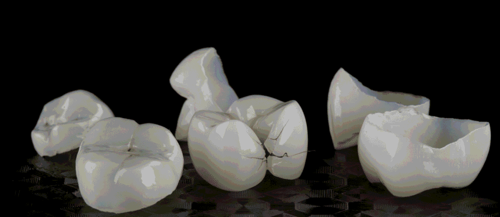why dental crowns keep breaking